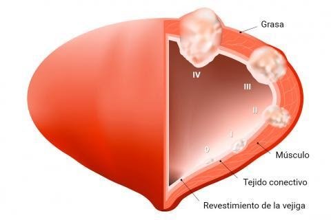 uro-oncologia